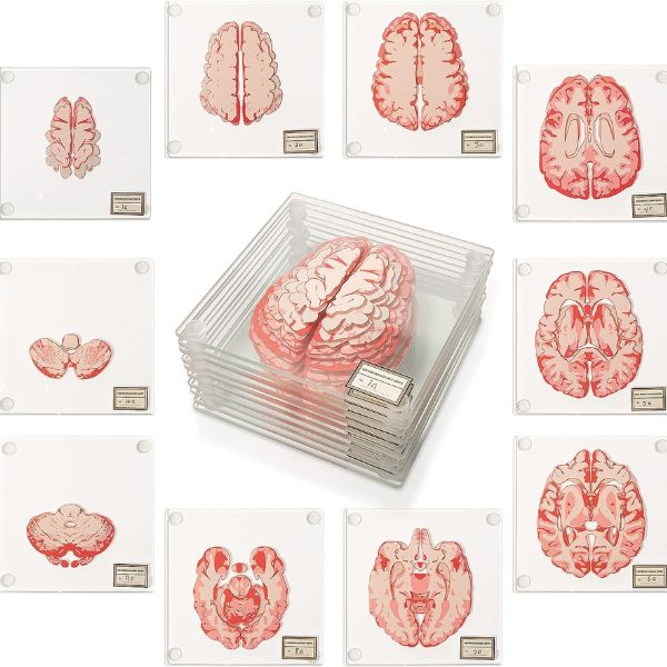 Anatomic Brain Specimen Coasters Set of 10 add an intriguing touch.