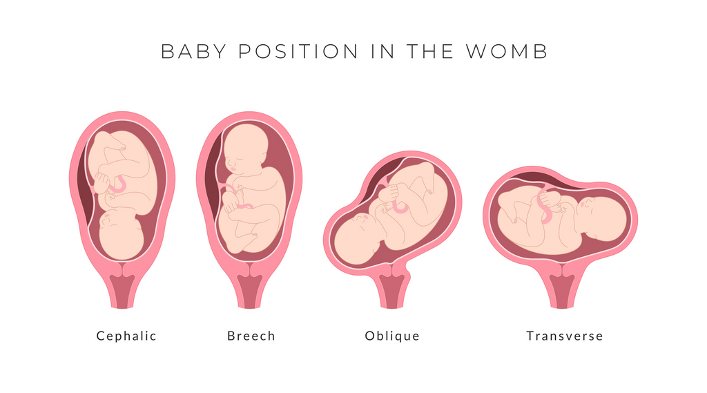 Baby Positions Before Birth