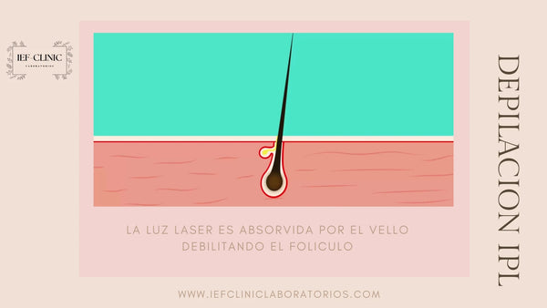 DEPILACION IPL BENEFICIOS CUANTAS SESIONES SE NECESITAN