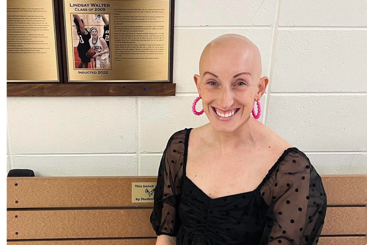 alopecia made lindsay walter empathetic and strong united states