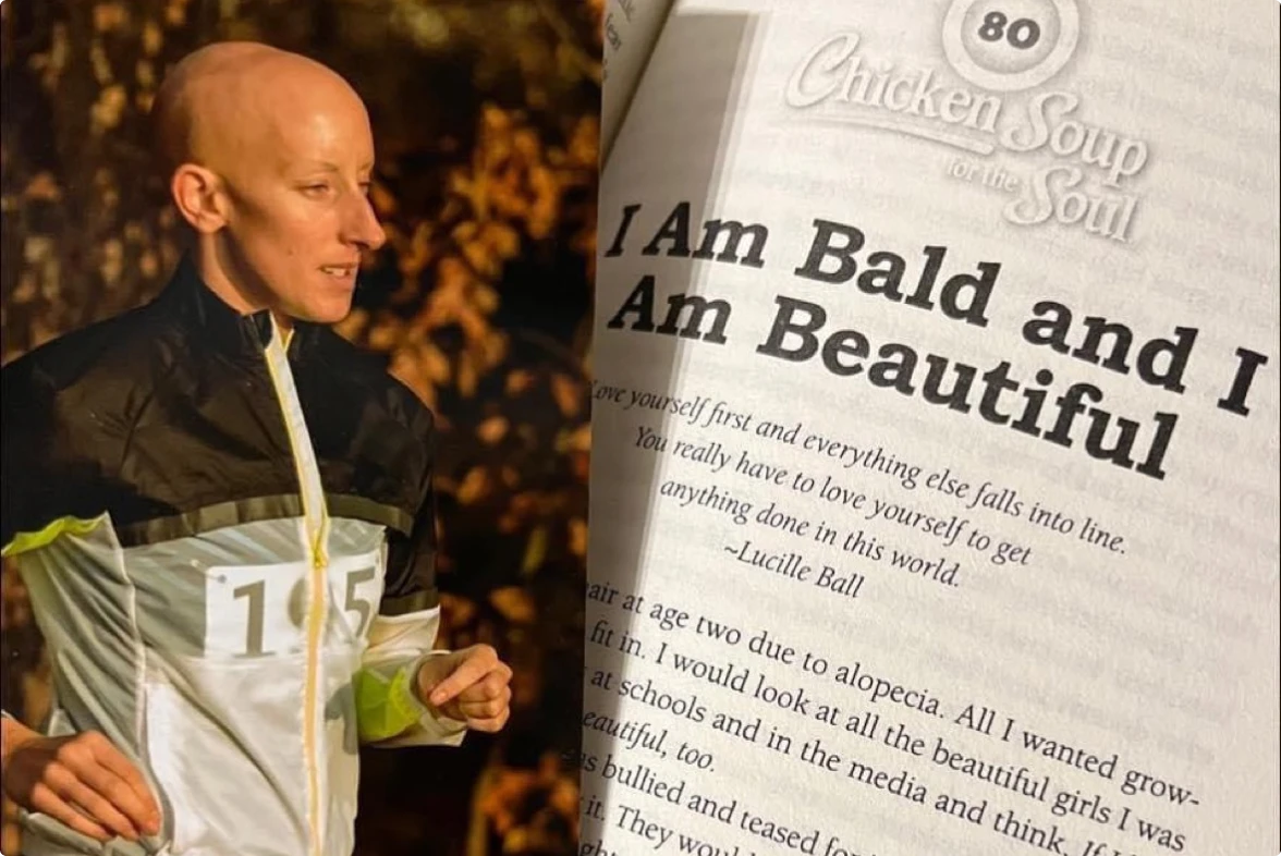 i am bald and i am beautiful united states