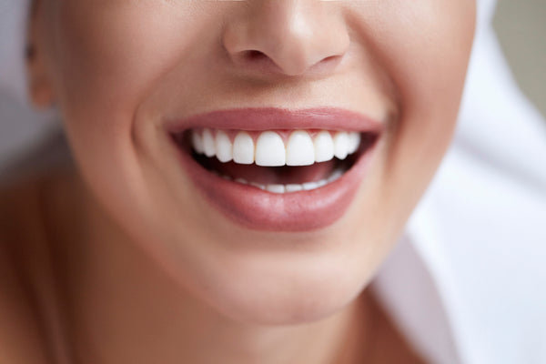 invisalign veneers