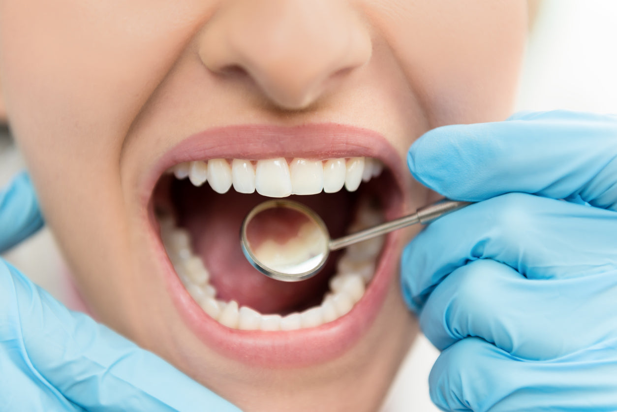 Can Braces Ruin My Teeth's Enamel? 