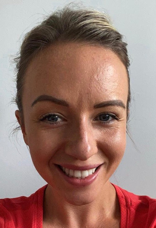 Teeth Straightening Remote Consultation | Oldham | Manchester Orthodontics