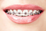 Good Oral Health | Oldham Orthodontics