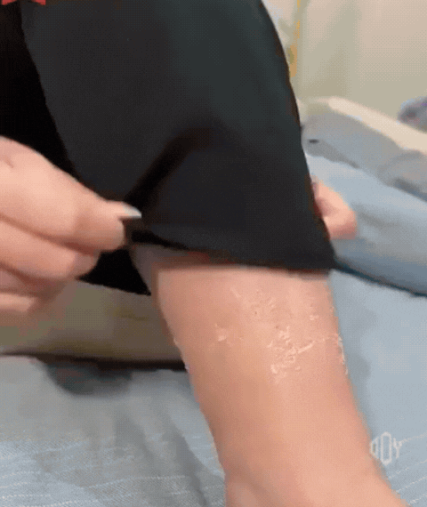 Showcasing the effective moisturizing property and instant relief DermaLux offer