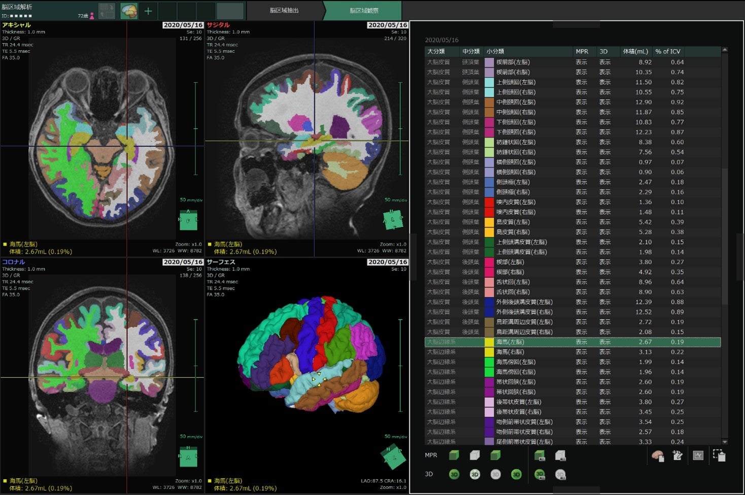 順天堂大学と富士フイルムがAI脳容積解析ソフトを開発、107区域抽出と高速処理を実現