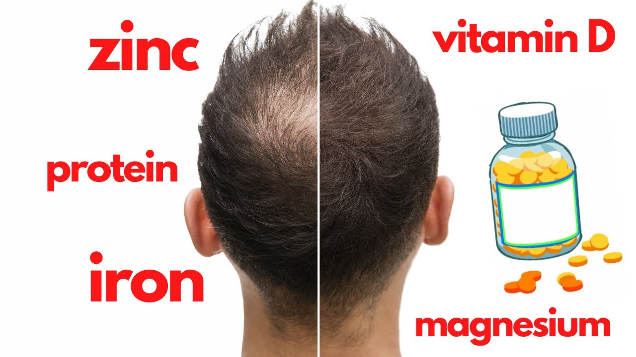6 Best Vitamins and Supplements For Thick Hair Growth  Careof