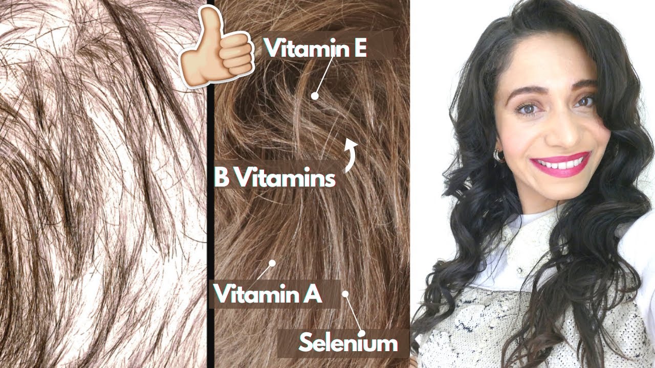 Hair Growth Vitamins  Biotin Anti Hair Loss Supplement for Thinning Hair   Hair Tablets for Women  Hair Regrowth Multivitamins Pills  Grow Longer  Stronger Healthy Hair Capsules  1 Month Hairburst