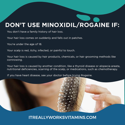 Does Minoxidil Make You Go Bald The TRUTH about Minoxidil Hair Shedding  Phase  YouTube