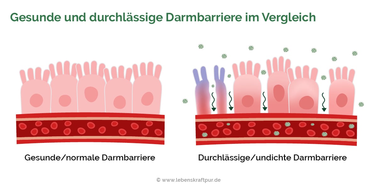 Gesunde und durchlässige Darmbarriere im Vergleich