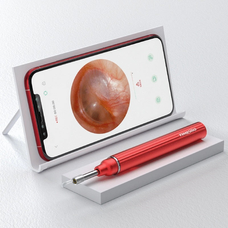3.9mm WiFi Ear Cleaner with HD Camera for Real-Time Wax Removal