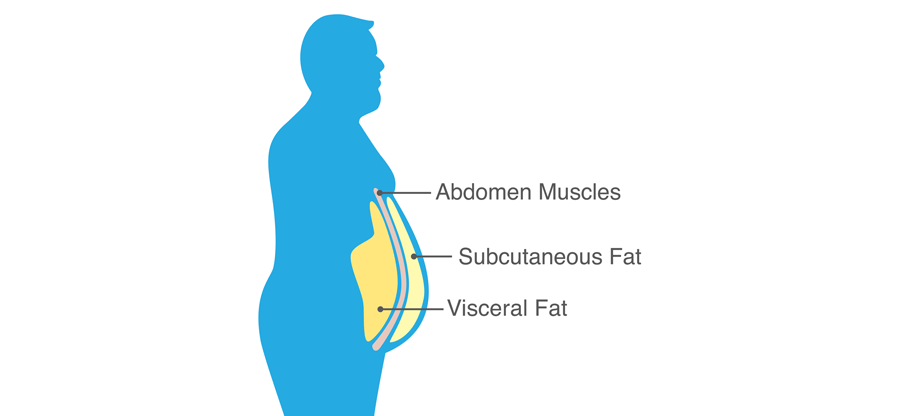 visceral fat vs belly fat