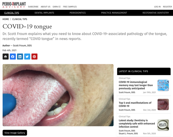 covid vaccine tongue side effect
