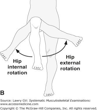 Hip external rotation example