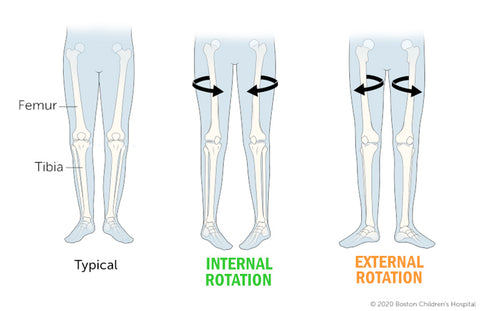 Hip internal/external rotation example