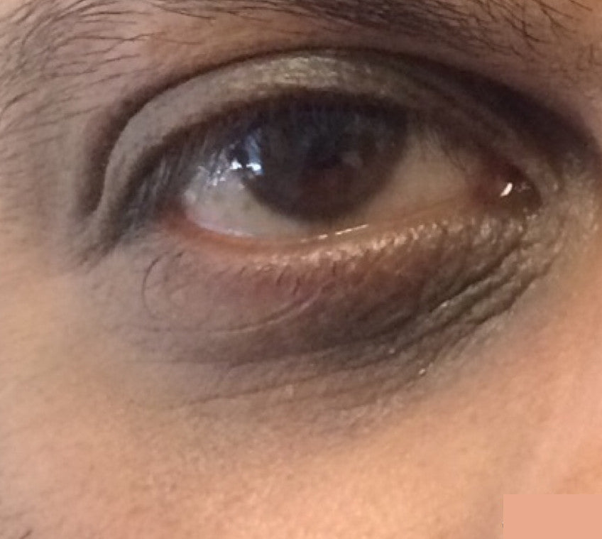 Enriched Retinol Eye Cream After