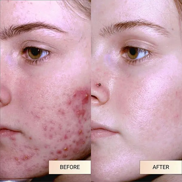 Before vs After
