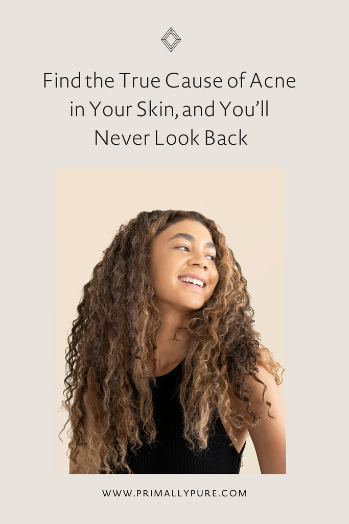 Find the True Cause of Acne in Your Skin, and You’ll Never Look Back | Primally Pure Skincare