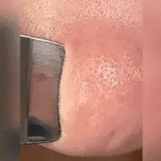 face scruber.gif__PID:2a597fd4-5238-4bd7-a140-622ce8737667