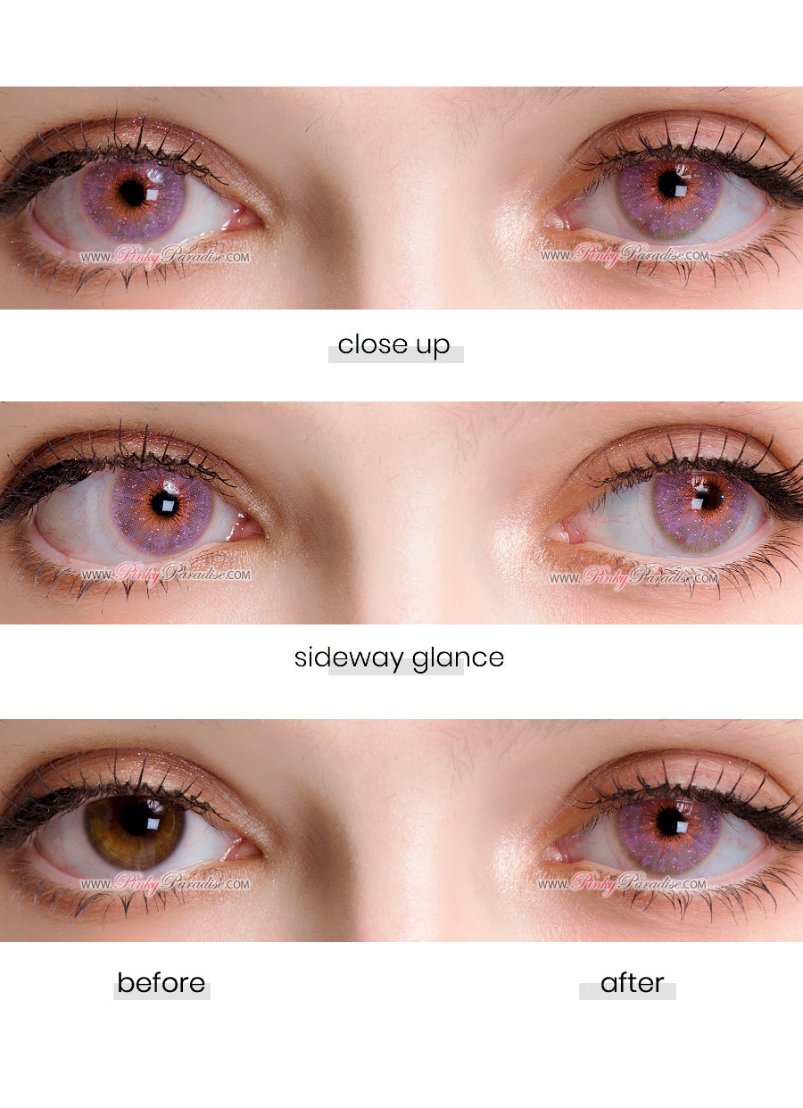 Before and After Captivating Eye Transformation with Uris Interstellar pink Colored contact lenses