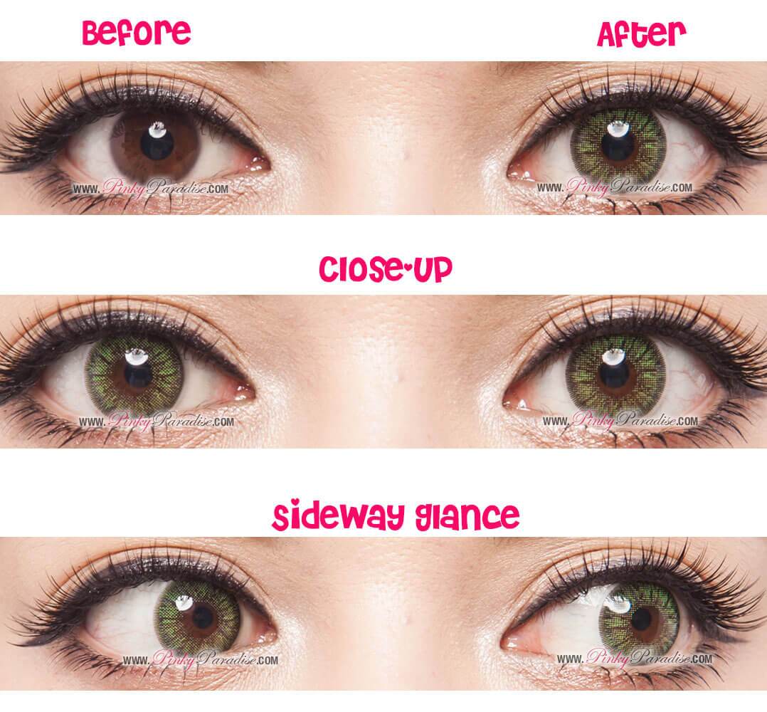 GBT Green Circle Lenses Before After