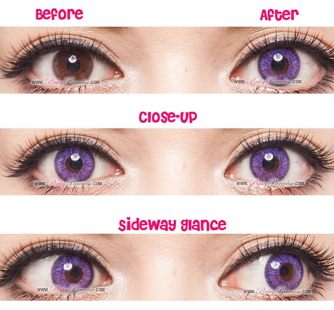 GBT Violet Circle Lenses Before After