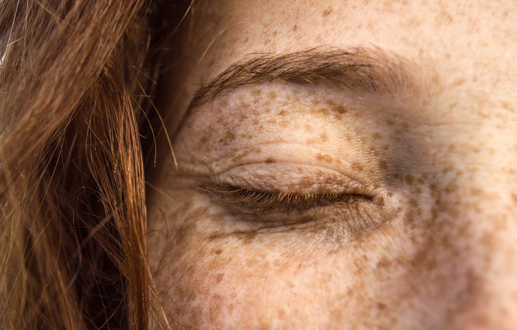 Close up of a young freckled woman's eye area with fine lines