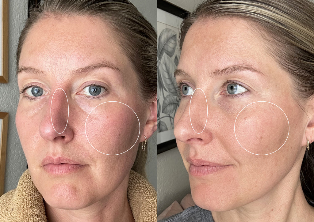 Erica's before & after trial results