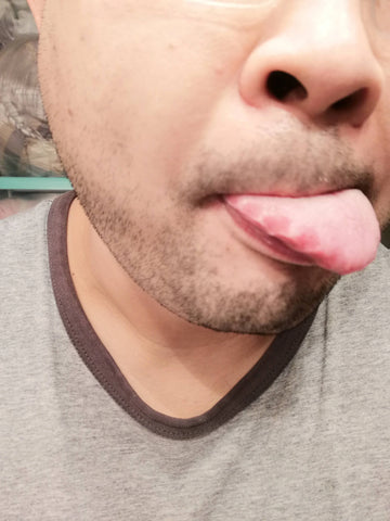 dry tongue from vapers tongue so stay hydrated