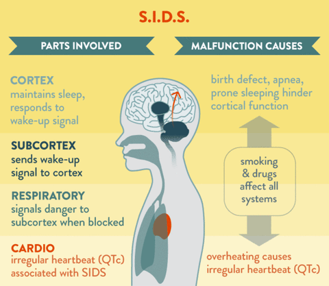 Factors of SIDS