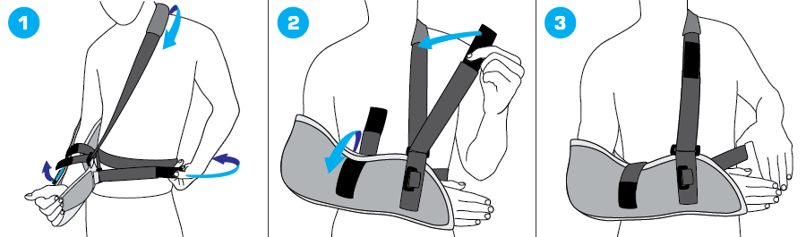 How To Apply - 303 Sponge Arm 