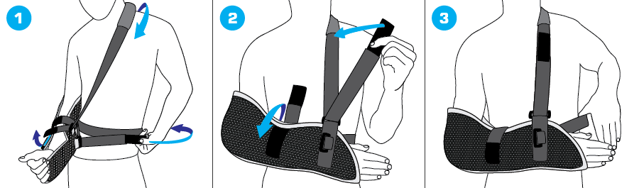 Neo G Arm Sling, Airflow Breathable, Universal Size