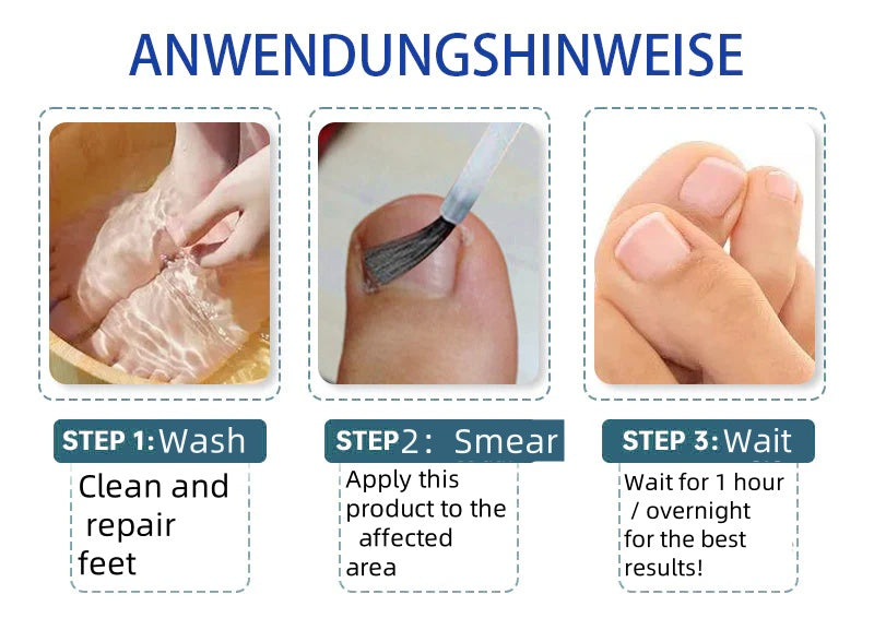 LOVILDS™Wasp Toxin Gray Nail Treatment