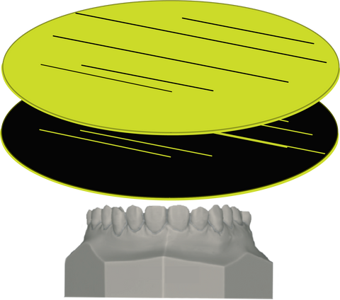 Custom Mouthguard