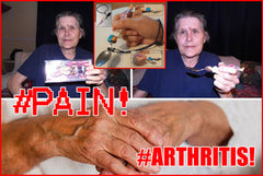 Elderly with eating issues. Arthritis in the hand, Pain, Strength and motion.