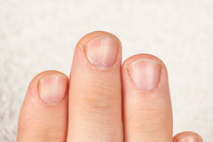 Dry, ragged cuticles, short nails, Blog: No more hangnails! Effective ways to heal and prevent ragged cuticles