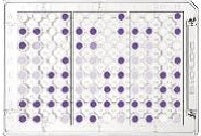 Yeast (YT) Plates