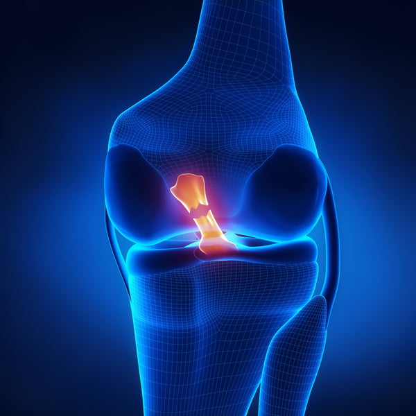 Posterior View of Torn PCL / Back of Right Knee. Anatomy behind the knee, knee clipart, clipart knee.