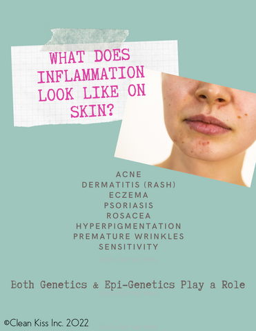 Acne inflammation on skin