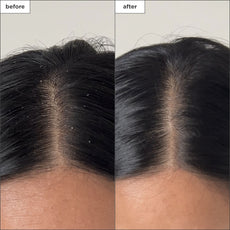 Scalp Revival Charcoal + Tea Tree Buildup Detox Spray