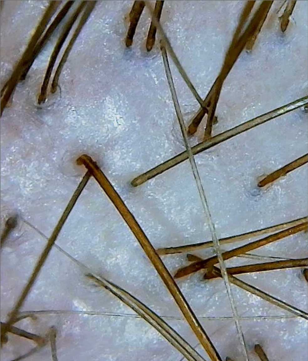 Micro-shot of scalp. 