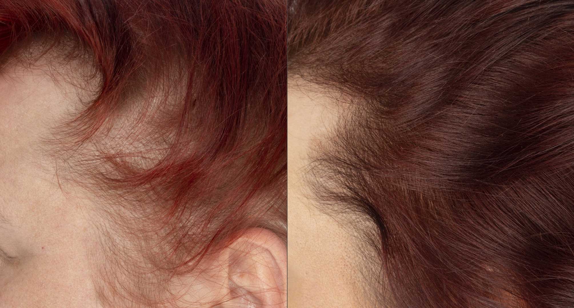 Close up of before and after image of red haired woman with thin hair and hair growth results over 16 weeks. 