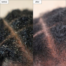 Scalp Revival Charcoal + Tea Tree Scalp Treatment