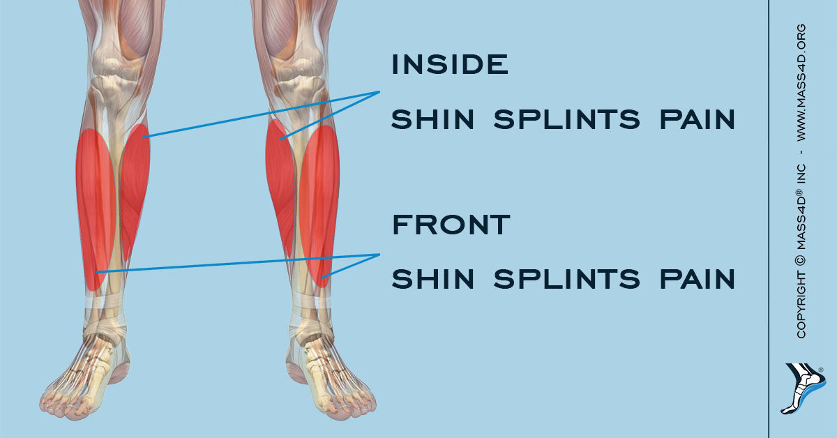 Causes And Symptoms Of Shin Splints Mass4d® Insoles Mass4d® Foot Orthotics 6339