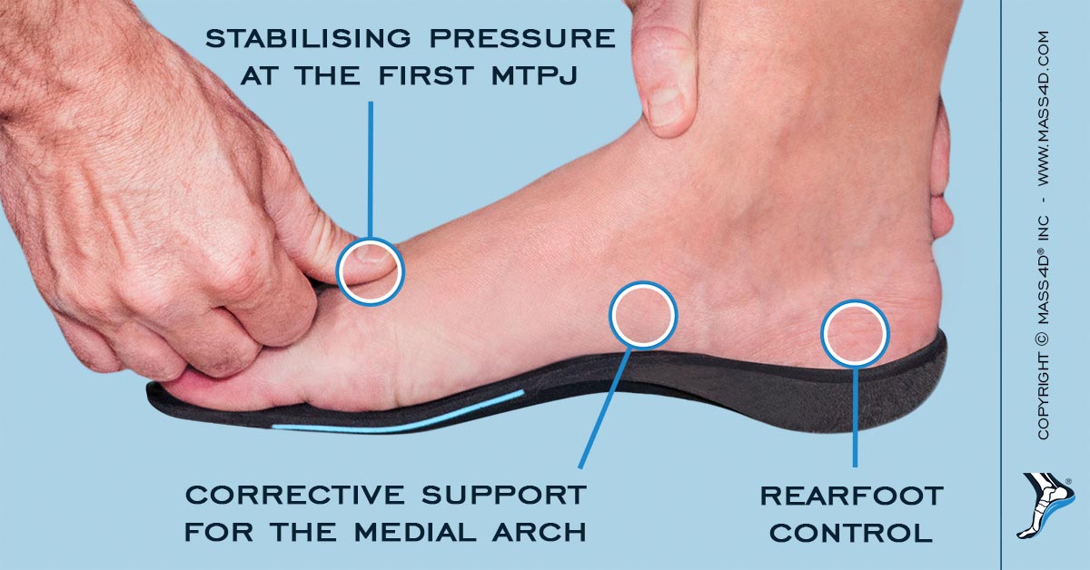 cavus foot support