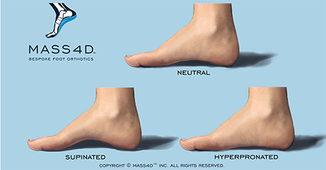 low arch vs high arch feet