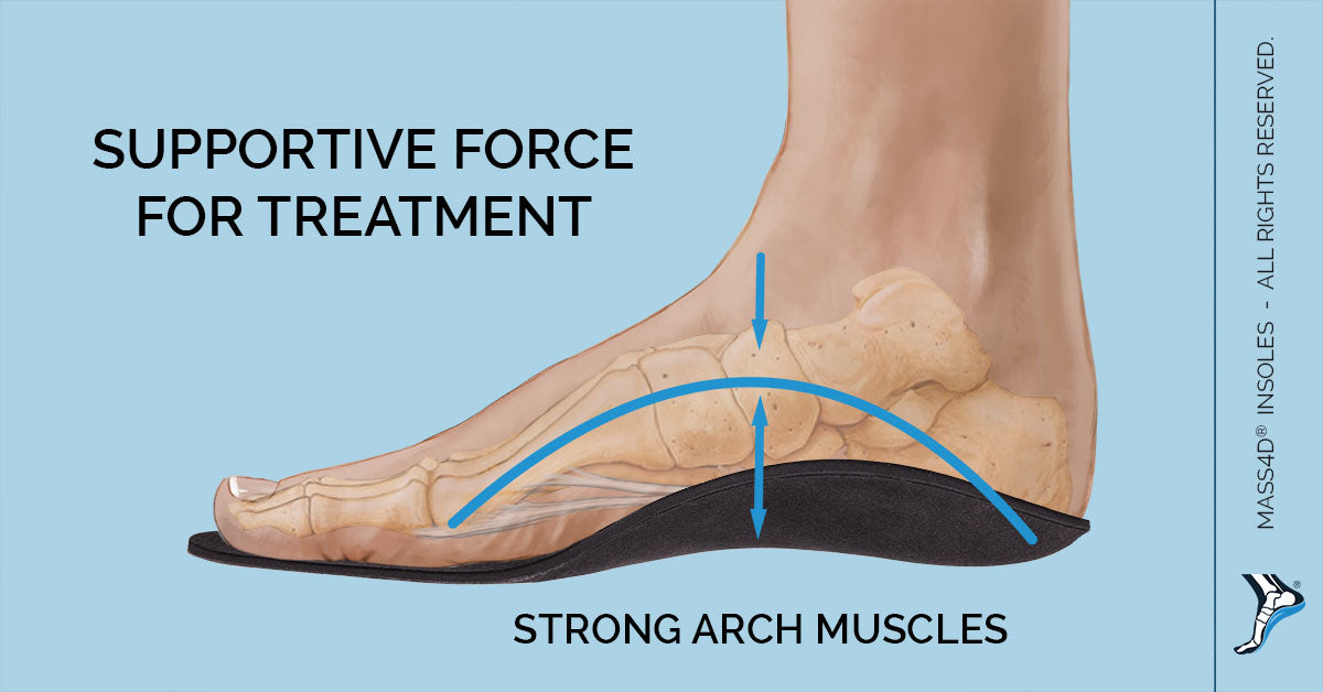 arch supporting bunion shoe inserts