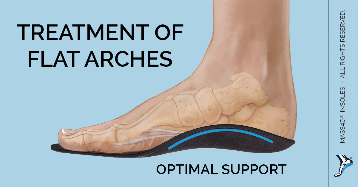 over the counter orthotics for flat feet