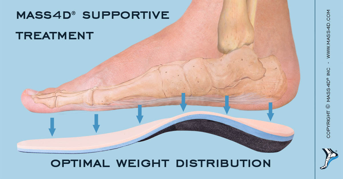 How To Manage Diabetic Foot Infections Mass4d® Foot Orthotics